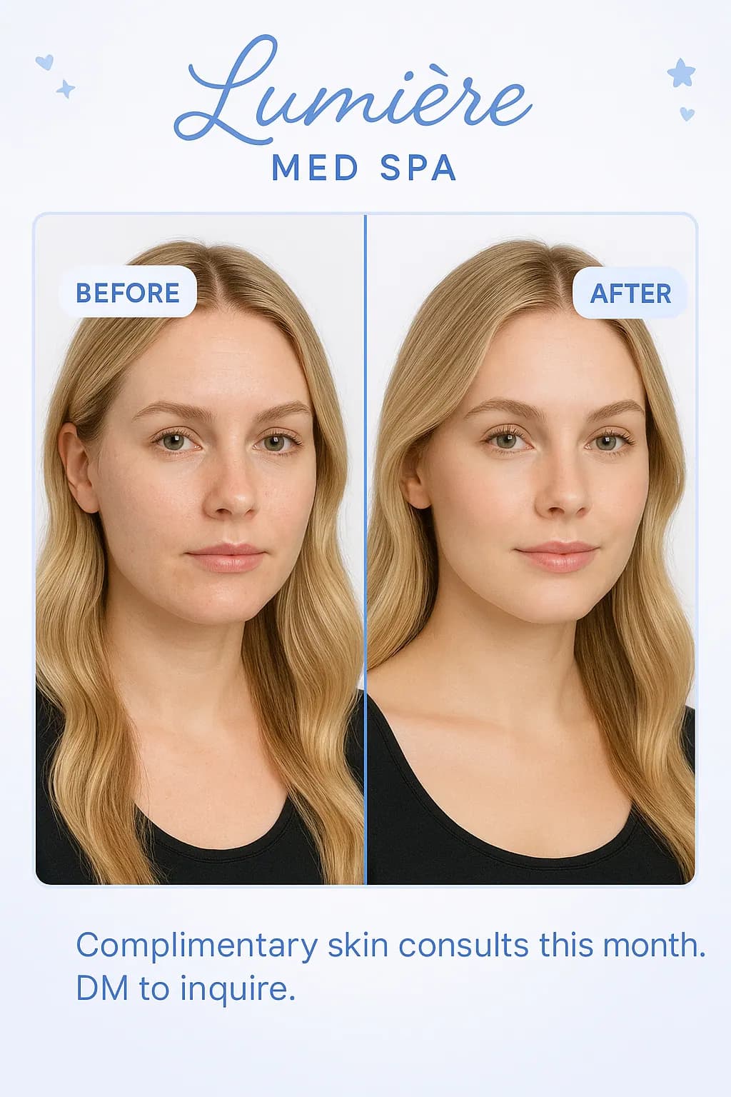 Med spa content calendar with automated caption suggestions